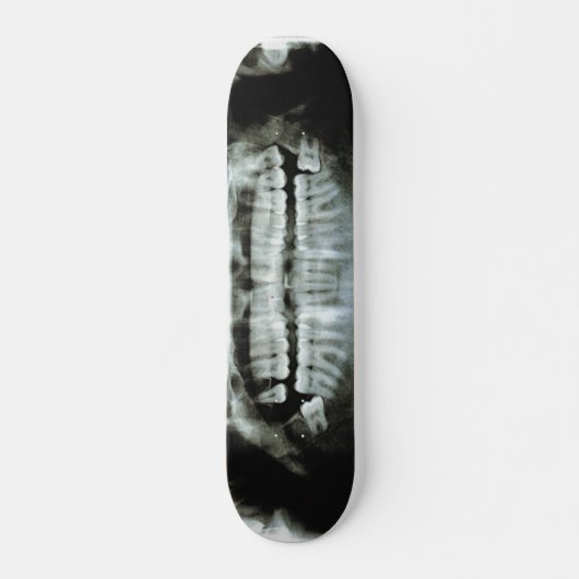 Röntgenstrahl Skateboard (Vorne)