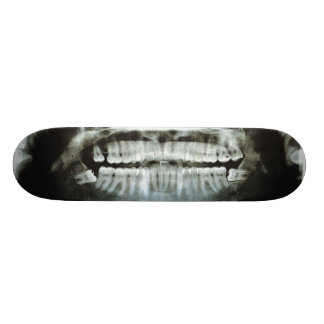 Röntgenstrahl Skateboard