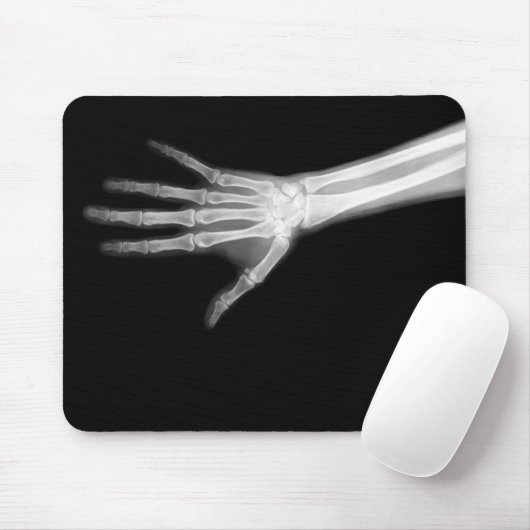 RÖNTGENSTRAHL-SKELETON ARM B&W MOUSEPAD (Mit Mouse)