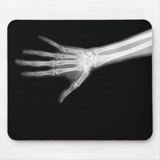 RÖNTGENSTRAHL-SKELETON ARM B&W MOUSEPAD (Vorne)