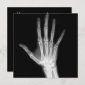 Röntgenstrahl-Skeleton Arme Schwarzes u. Weiß Einladung (Vorne/Hinten)