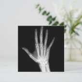 Röntgenstrahl-Skeleton Arme Schwarzes u. Weiß Einladung (Stehend Vorderseite)