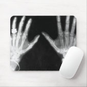 Röntgenstrahl-Skeleton Hände u. Schmuck - B&W Mousepad (Mit Mouse)