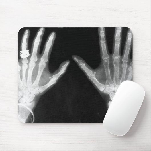 Röntgenstrahl-Skeleton Hände u. Schmuck - B&W Mousepad (Mit Mouse)
