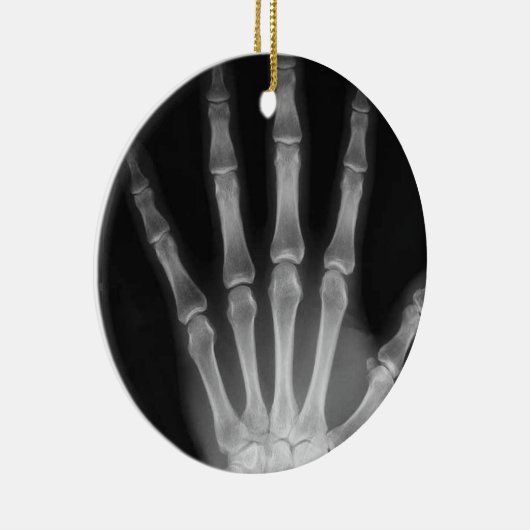 RÖNTGENSTRAHL-SKELETON HANDfinger B&W Keramikornament (Rechts)
