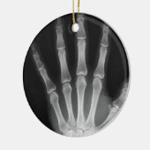 RÖNTGENSTRAHL-SKELETON HANDfinger B&W Keramikornament (Links)
