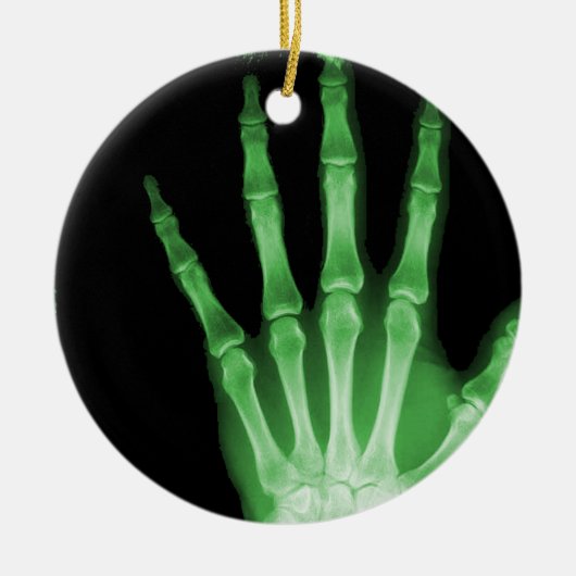 RÖNTGENSTRAHL-SKELETON HANDfinger-GRÜN Keramik Ornament (Vorne)