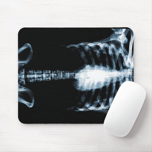 RÖNTGENSTRAHL-SKELETON TORSO-RIPPEN - BLAU MOUSEPAD (Mit Mouse)