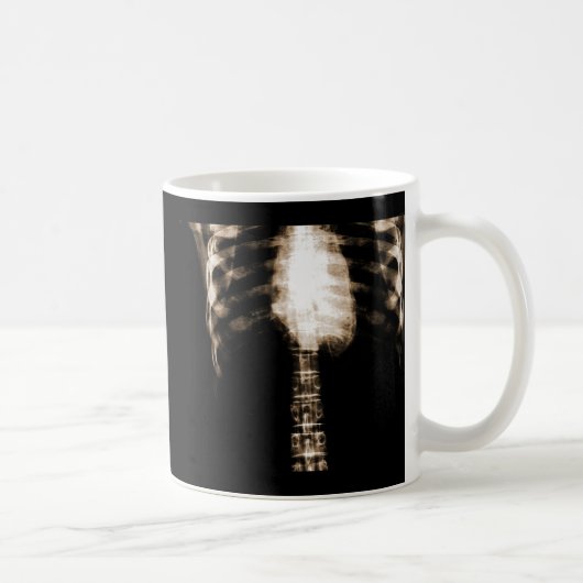 RÖNTGENSTRAHL-SKELETON TORSO-RIPPEN - SEPIA KAFFEETASSE (Rechts)