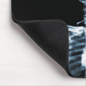 Röntgenstrahl-Visions-blaues Single-Skelett Mousepad (Ecke)