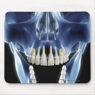 Röntgenstrahlartblick auf menschliche Zähne Mousepad