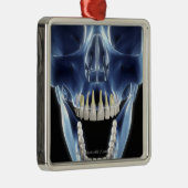 Röntgenstrahlartblick auf menschliche Zähne Ornament Aus Metall (Rechts)