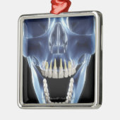 Röntgenstrahlartblick auf menschliche Zähne Ornament Aus Metall (Links)