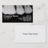 Röntgenstrahlen der Zähne Visitenkarte (Vorne/Hinten)