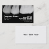 Röntgenstrahlen der Zähne Visitenkarte (Vorne/Hinten)