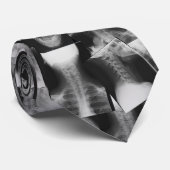 röntgt krawatte (Gerollt)