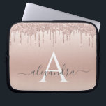 Rosa-Glitzer und Sparklogramm Laptopschutzhülle<br><div class="desc">Rosa Rose Gold Imitate Glitzer und sparkle Elegant Monogram Case. Dieser Fall kann so angepasst werden,  dass er Ihren Anfangs- und Vornamen enthält.</div>