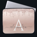 Rosa-Glitzer und Sparklogramm Laptopschutzhülle<br><div class="desc">Rosa Rose Gold Imitate Glitzer und sparkle Elegant Monogram Case. Dieser Fall kann so angepasst werden,  dass er Ihren Anfangs- und Vornamen enthält.</div>