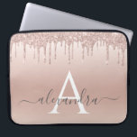 Rosa-Glitzer und Sparklogramm Laptopschutzhülle<br><div class="desc">Rosa Rose Gold Imitate Glitzer und sparkle Elegant Monogram Case. Dieser Fall kann so angepasst werden,  dass er Ihren Anfangs- und Vornamen enthält.</div>