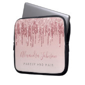 Rosa-Gold-Glitter-Monogramm Laptopschutzhülle (Vorderseite Links)