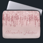 Rosa-Gold-Glitter-Monogramm Laptopschutzhülle<br><div class="desc">Blush Pink - Rose Gold Imitat Dripping Glitzer und sparkle elegante Monogram Girly Niedlich Laptop Computer Case oder Sleeve. Dieser Fall kann so angepasst werden,  dass er den Namen Ihres Signaturskripts enthält.</div>
