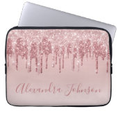 Rosa-Gold-Glitter-Monogramm Laptopschutzhülle (Vorderseite)