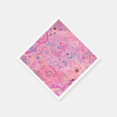 Rosa Party Maximalistische Kunst Serviette (Ecke)