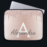 Rosa Rose Gold Metallischer Glitzer Monogramm Laptopschutzhülle<br><div class="desc">Rosa Rose Gold Glitzer und glatter,  moderner und eleganter Monogramm-Case. Dieses Gehäuse kann auf Ihren Anfangs- und Vornamen angepasst werden und macht ein großartiges mädchenhaftes oder süßes 16 Geburtstagsgeschenk.</div>