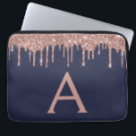 Rosa Rose Gold Navy Blue Glitzer Sparkgram Monogra Laptopschutzhülle<br><div class="desc">Rosa Rose Gold und Navy Blue Imitate Dripping Modern and Elegant Girly Glitzer and Sparkle Elegant Monogram Case. Dieser Fall kann so angepasst werden,  dass er Ihren Anfangs- und Vornamen enthält.</div>