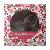 Rosa Rosen Custom Ultrasound Mutter Day Tile Fliese (Vorderseite)