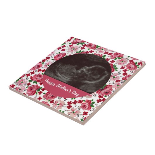 Rosa Rosen Custom Ultrasound Mutter Day Tile Fliese (Seite)