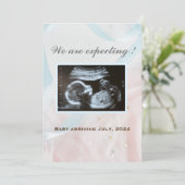 Rosa und blaue Bänder mit Baby-Ultraschall Ankündigung (Stehend Vorderseite)
