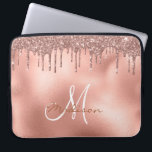 Rose Gold Glitzer Tropfen Monogram Laptopschutzhülle<br><div class="desc">Dieses Design kann in dem Bereich personalisiert werden, der durch das Ändern des Fotos und/oder Textes zur Verfügung gestellt wird. Sie können auch angepasst werden, indem Sie auf Vorlage personalisieren klicken und dann auf die Schaltfläche klicken, um weitere Optionen anzupassen, um die Hintergrundfarbe zu löschen oder zu ändern, Text hinzuzufügen,...</div>