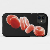 Rote Blutkörperchen Case-Mate iPhone Hülle (Rückseite (Horizontal))