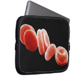 Rote Blutkörperchen Laptopschutzhülle (Vorne Rechts)