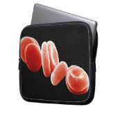 Rote Blutkörperchen Laptopschutzhülle (Vorderseite Links)
