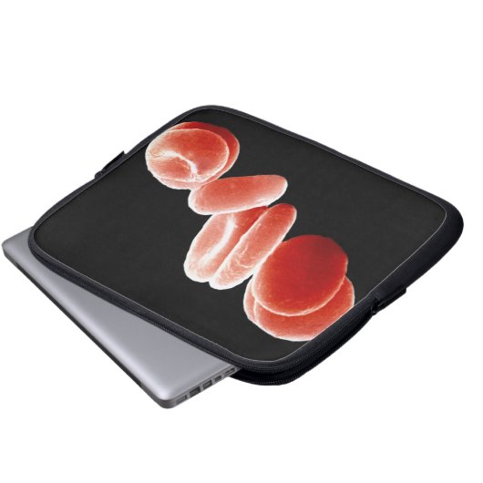 Rote Blutkörperchen Laptopschutzhülle (Vorne Knopf)