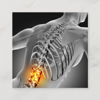 Rücken Schmerzen Foto Graphic Square Chiropractic Quadratische Visitenkarte