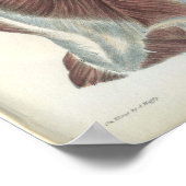 Rückenmuskeln Anatomie Druck Poster (Ecke)