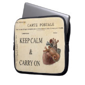 Ruhe bewahren und Elektronik-Bag-Laptop-Lee tragen Laptopschutzhülle (Vorderseite Links)