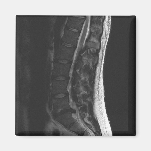 Rupted Disk Magnet (Vorne)