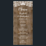Rustikale Hochzeit von Stallholz Menükarte<br><div class="desc">Dieses rustikale Hochzeitsmenü bietet einen Hintergrund aus Stallholz und eine weiße Spitze,  die über dem Wort "menu" in modernen weißen Kalligraphie-Stil-Skript ragt. Passen Sie die Erholung des Textes mit den Namen der Braut und Bräutigam,  Datum und Menü an. Die Rückseite weist ein passendes Holzmuster auf.</div>