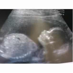 Schaffen Sie Ihren eigenen Magneten, Freistehende Fotoskulptur