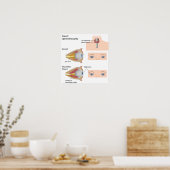 Schilddrüsenaugenerkrankung Poster (Küche)