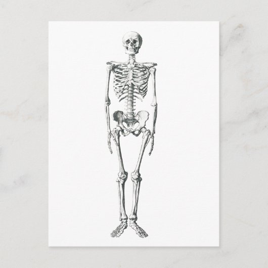Schlecht am Knochen Postkarte (Vorderseite)