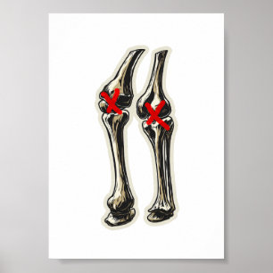 Schlechte Knie – Lustige Skelett-Knie-Illustration Poster