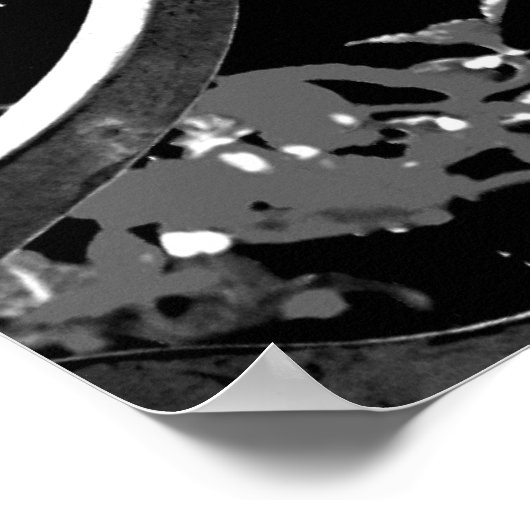 Schmiedeeisendekor Poster (Ecke)