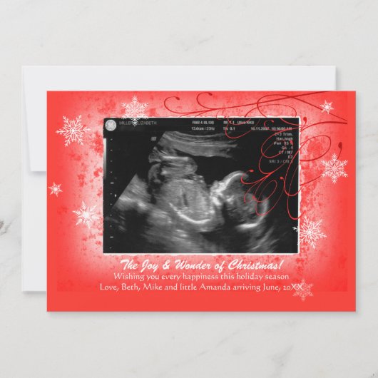 Schneeflocken Ultrasound Holiday Card Feiertagskarte (Vorderseite)