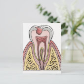Schnittbild mit Zahnextraktion Postkarte (Stehend Vorderseite)