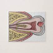 Schnittbild mit Zahnextraktion Puzzle (Horizontal)